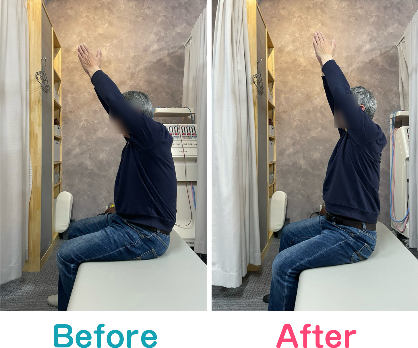 ビフォーアフター写真