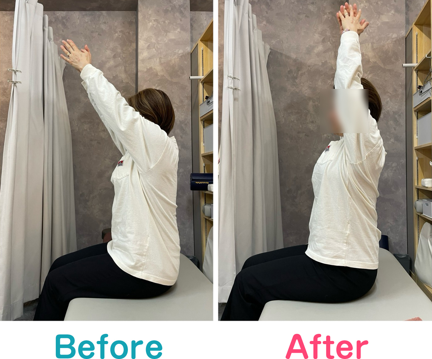 ビフォーアフター写真