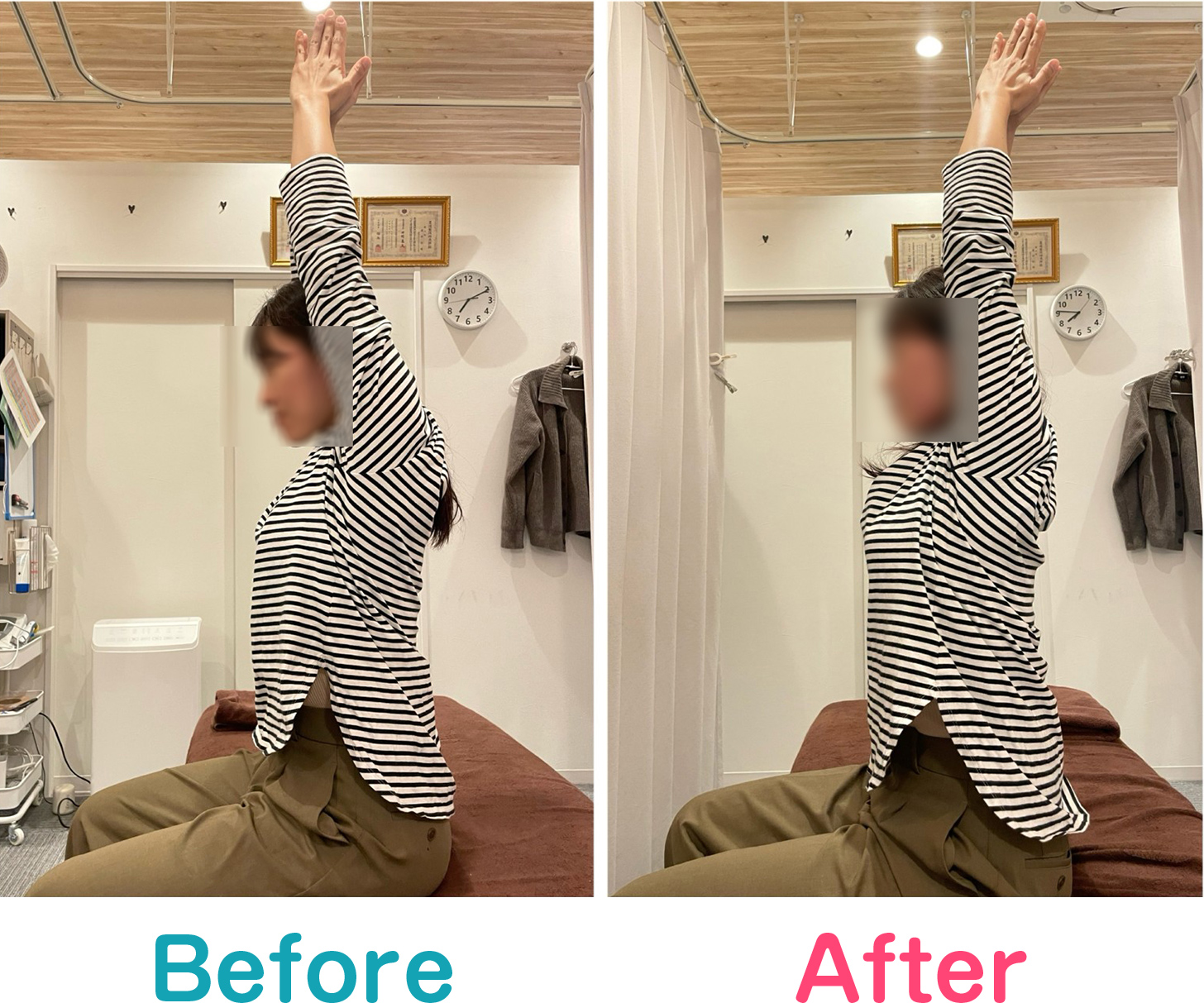 ビフォーアフター写真