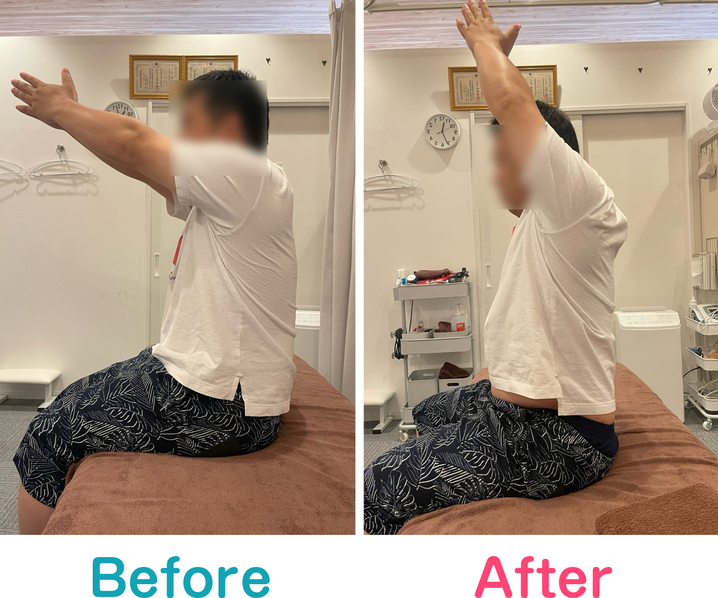 ビフォーアフター写真